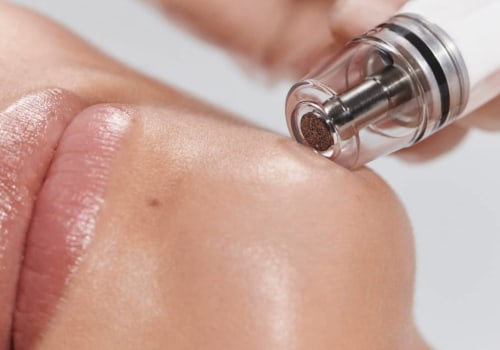 Does a Diamond Glow Facial Hurt?